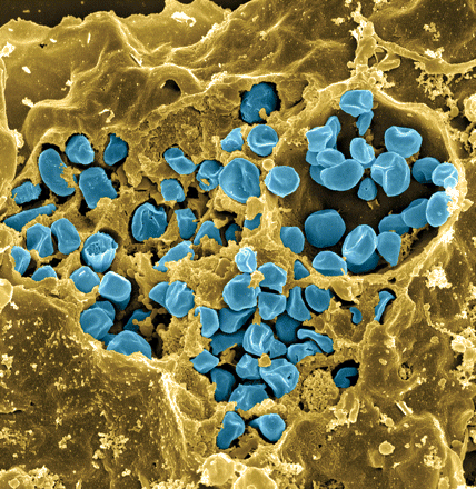 tularemia bacteria